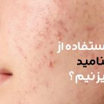 چرا بعد از استفاده از نیاسینامید جوش میزنیم؟